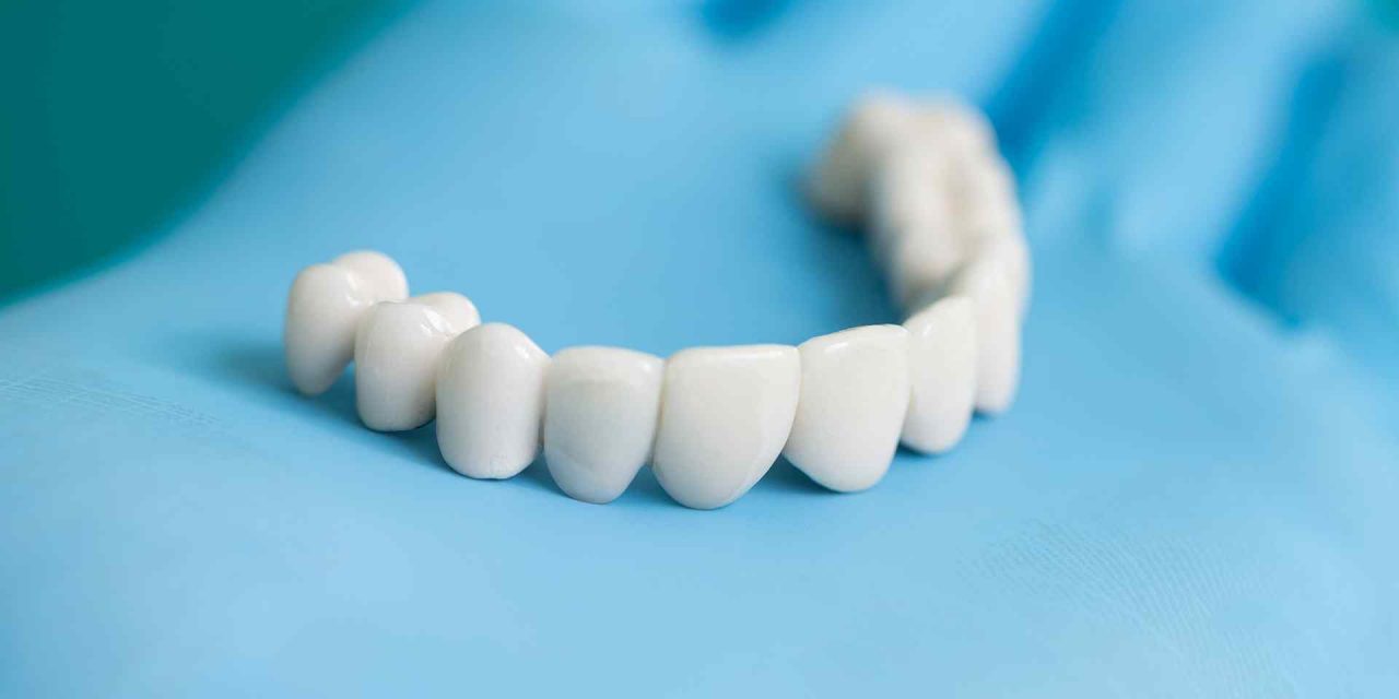 https://papadopulosdent.com/wp-content/uploads/2020/01/post_07-1280x640.jpg